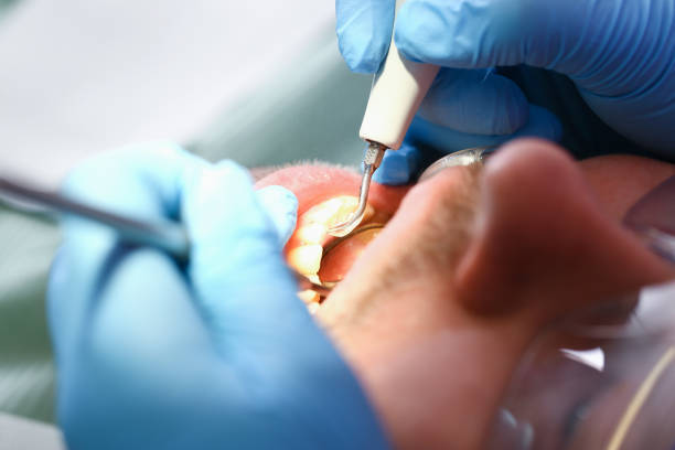 Best Emergency Dentist for Special Needs Patients in Robinson, TX