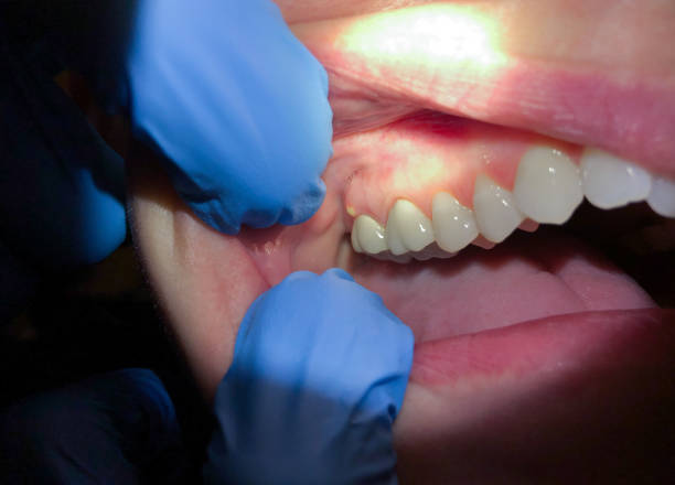 Best Emergency Dentist for Knocked-Out Tooth in Robinson, TX