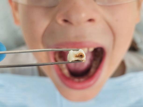 Best Emergency Dental Services for Seniors in Robinson, TX